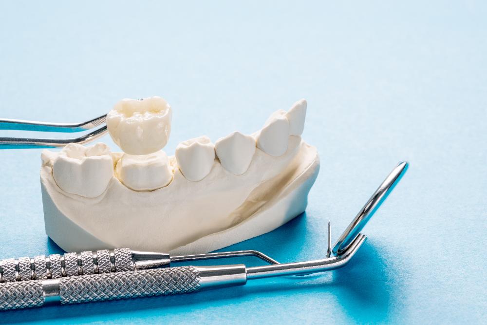 image of a dental crown and dental tool in burke va