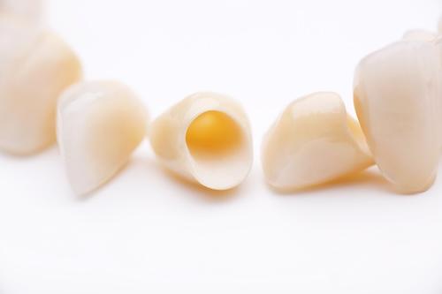 image of dental crowns in burke va