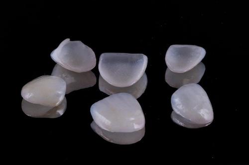 image of porcelain veneers in burke va