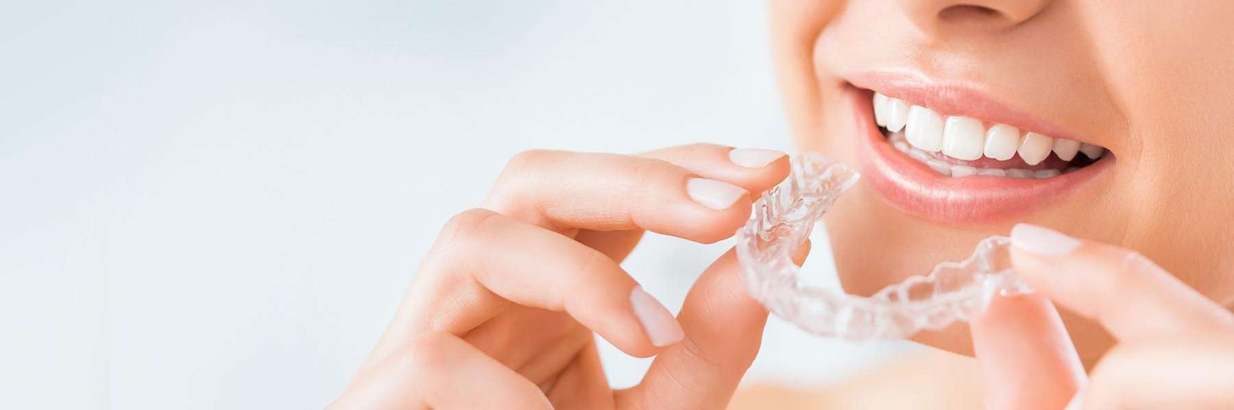 invisalign in burke